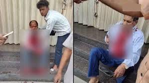 Surat માં ધોળા દિવસે જ્વેલરી શોપમાં દુકાનદારના ગળા કાપી લૂંટનો પ્રયાસ