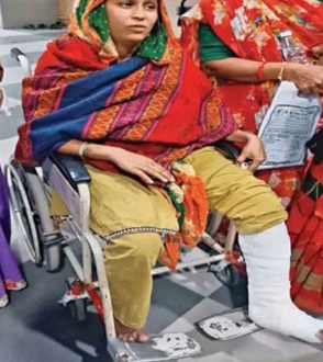 Surendranagar રાત્રિના સુમારે સફાઈ કરતા મહિલા કર્મીને કાર અડફેટે ઈજા