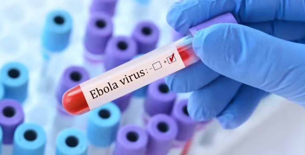 Ebola virus અંગે કેન્દ્ર સરકારની એડવાઈઝરી જાહેર