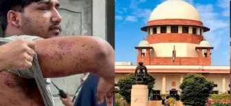 CJP ના વિરોધ પ્રદર્શન દરમિયાન પેલેટ ગનનો ઉપયોગ પડકારતી અરજી પર સુપ્રીમ કોર્ટે કેન્દ્ર સરકારને નોટિસ જારી કરી